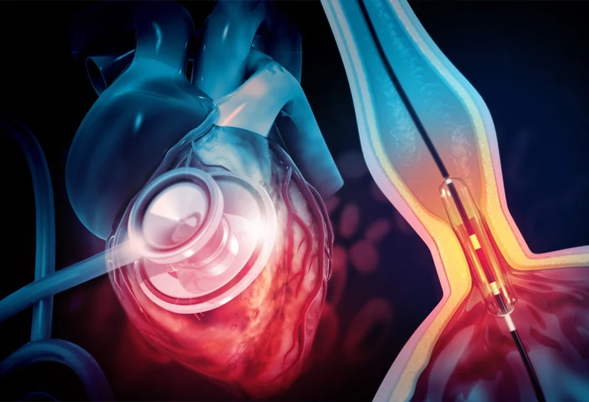What is the Cost of Coronary Angiography in Patna?